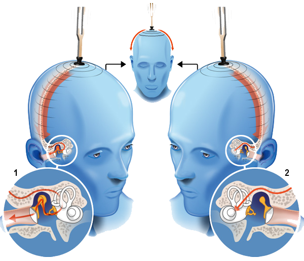 Hearing test
