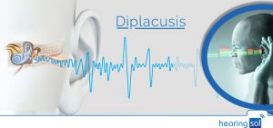 Diplacusis | Facing The Bizarre Reality of Double Hearing