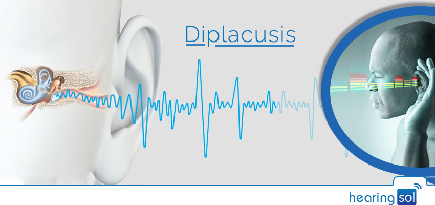 Diplacusis