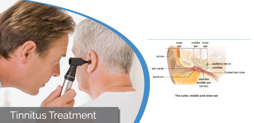 tinnitus-treatment