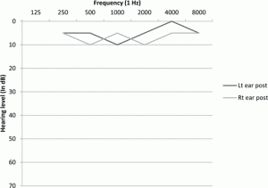 graph after treatment