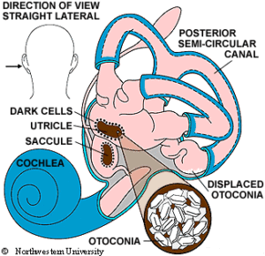 How Does Head Trauma Cause Hearing Loss Hearing Sol