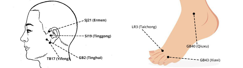 Acupuncture Points