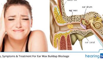 Causes, Symptoms & Treatment For Ear Wax Buildup Blockage