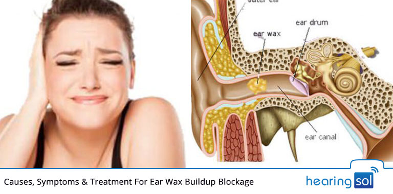 Causes, Symptoms & Treatment For Ear Wax Buildup Blockage
