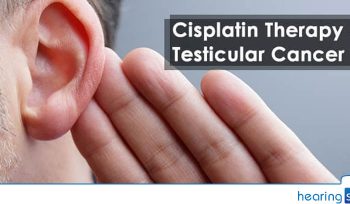 Cisplatin Therapy For Testicular Cancer & Hearing Loss [Study & Analysis]