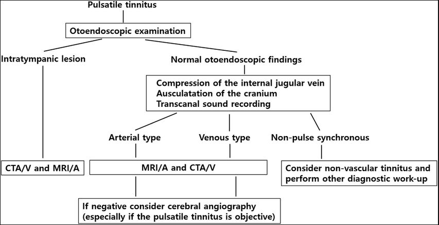Diagnostic algorithm for pulsatile tinnitus