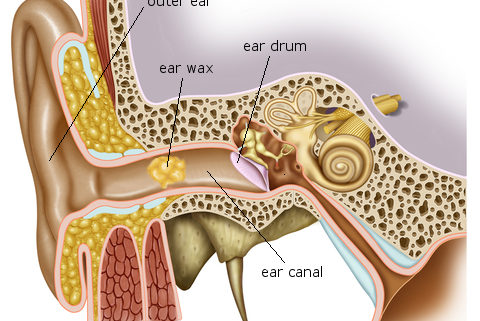 Ringing In Ears From Too Much Wax Ringing In Ears From Too Much Wax