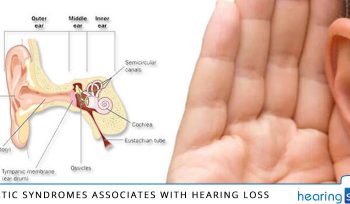 Genetic-Syndromes-associated-with-Hearing-Loss