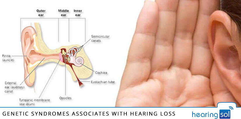 Genetic-Syndromes-associated-with-Hearing-Loss