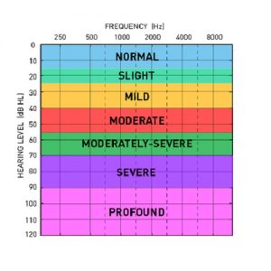 audiogram look like if one ear is better than the other and it's not masked during a hearing test