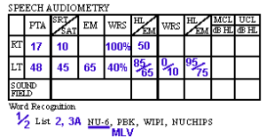 What are the features of a modern hearing test?