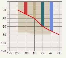 How important are channels in hearing aids?