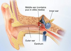 Middle ear infusion