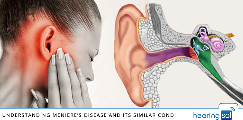 Understanding Menieres Disease And Its Similar Conditions