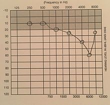 Audiogram