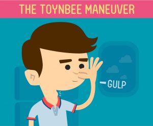 Toynbee maneuver