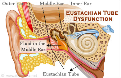 Eustachian Tube