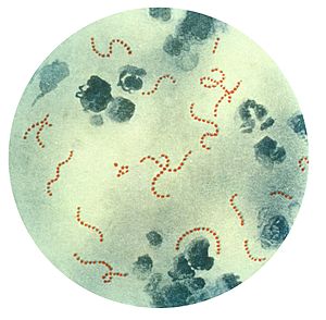 Streptococcus pyogenes (stained red), a common group A streptococcal bacterium.