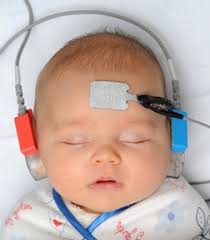 newborn Baby Hearing Screening