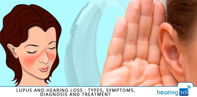 Lupus And Hearing Loss : Types, Symptoms, Diagnosis And Treatment