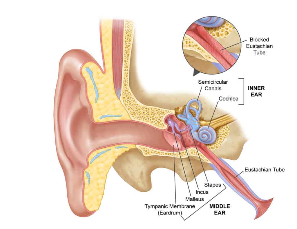 Eustachian tube blockage