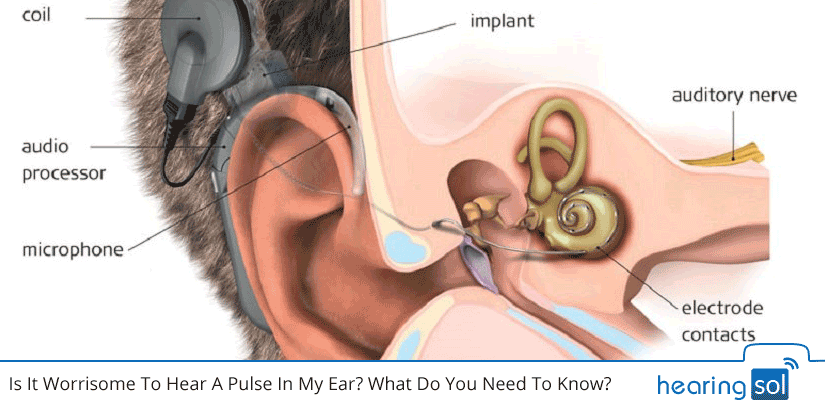 Is It Worrisome To Hear A Pulse In My Ear