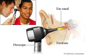 Otoscopic exam