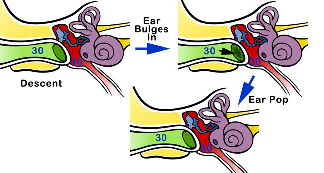 Ear Noises | Know About unusual Weird Sounds Inside Your Ear