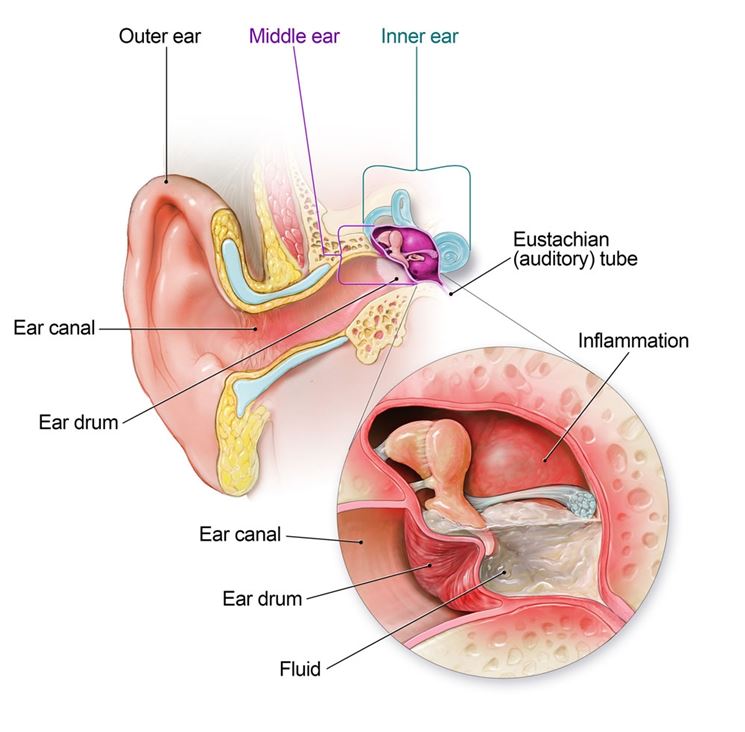 ear discharge