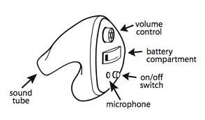 ite-hearing-aid1