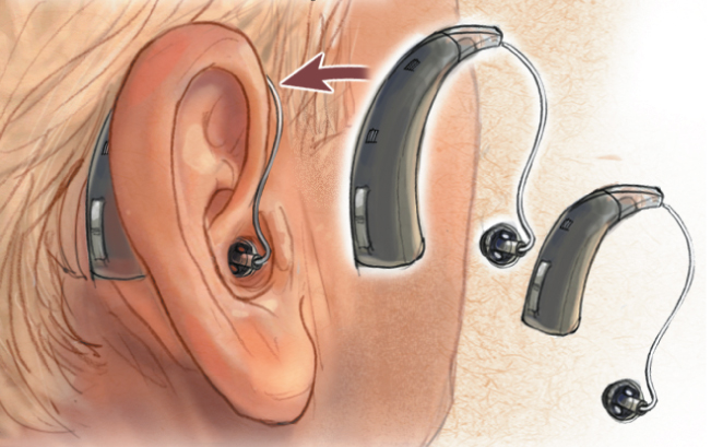 RIC hearing aids