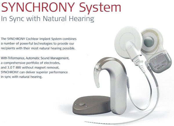 Synchrony Cochlear implant system