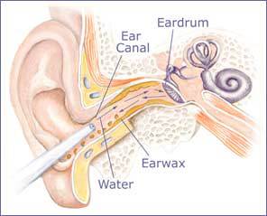 Ear irrigation