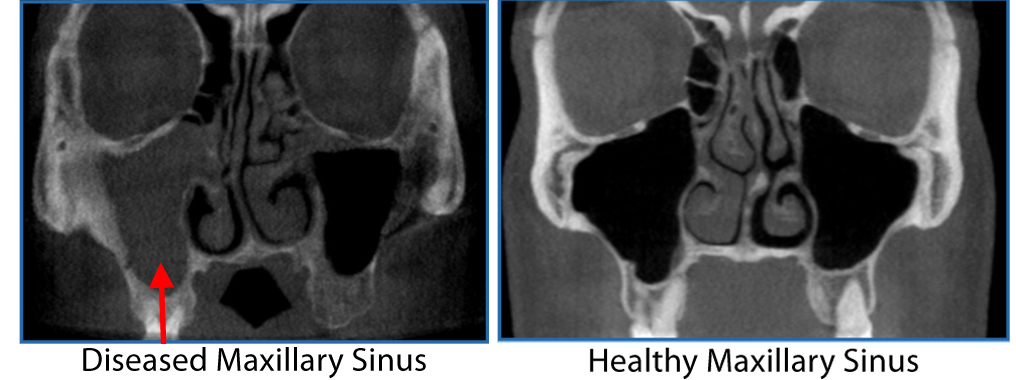 CT Scan