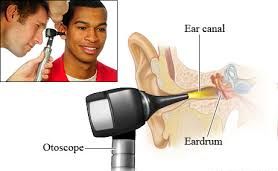 Otoscope