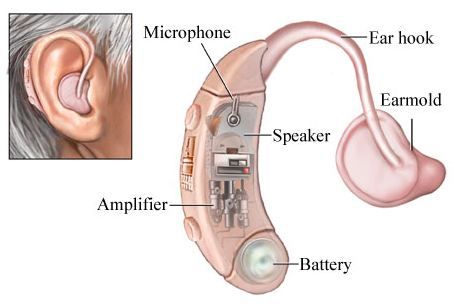 Parts of BTE hearing aids