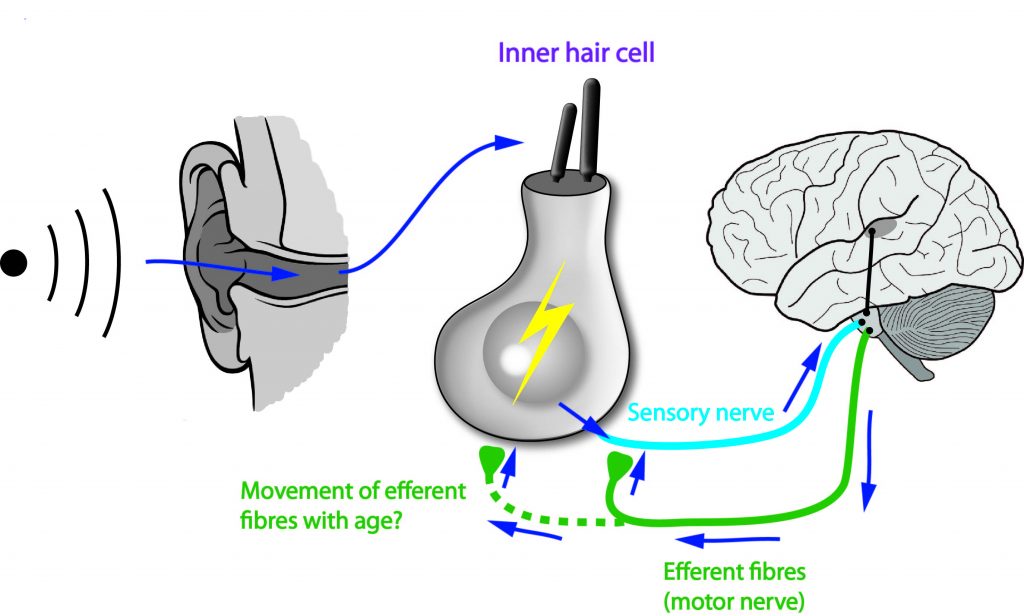 age - related hearing loss