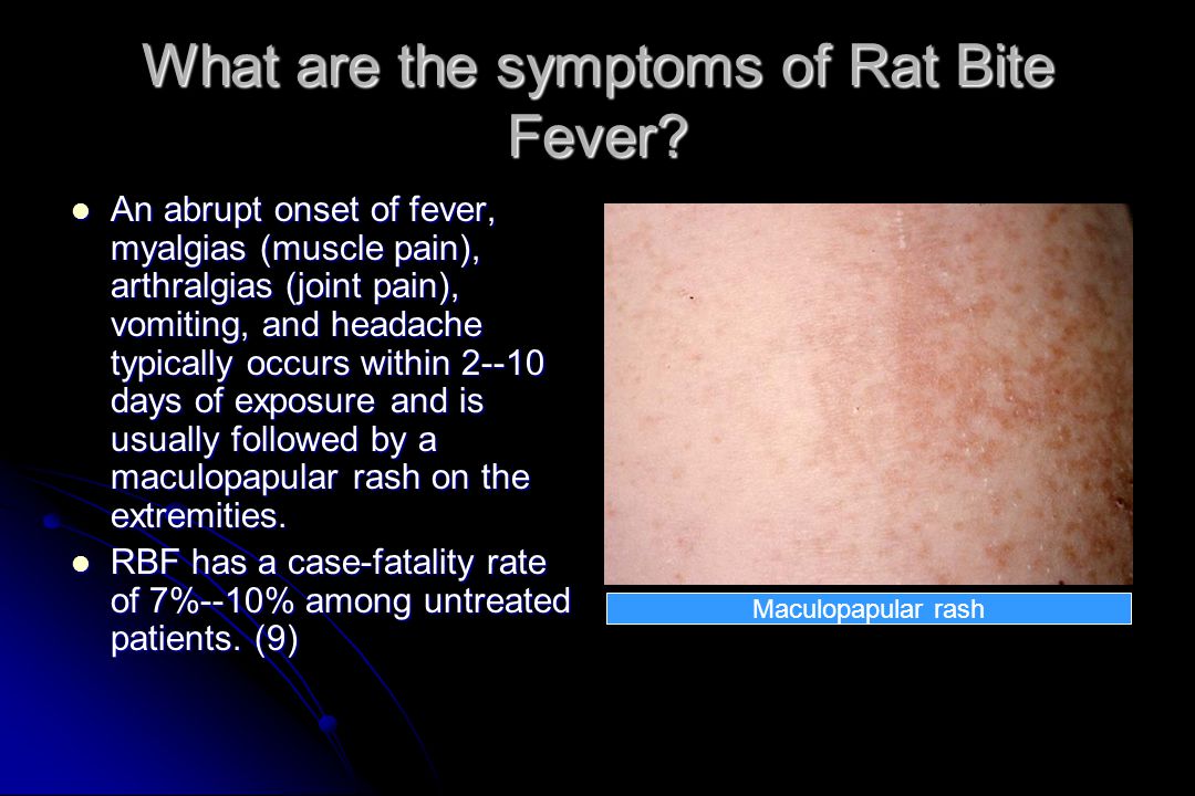 Rat Bite Fever