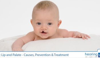 Cleft Lip and Palate - Causes, Prevention & Treatment