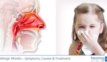 Allergic Rhinitis Symptoms, Causes, Treatment and Remedies