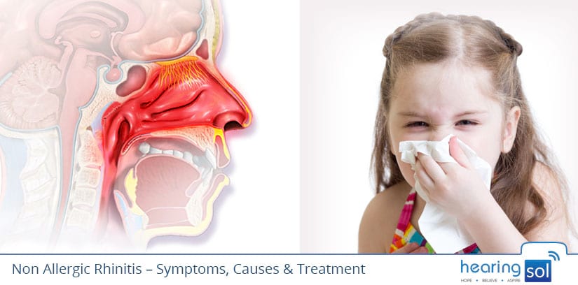 Non Allergic Rhinitis | Symptoms, Causes & Best Treatment