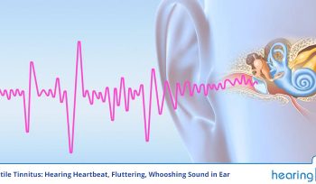 Pulsatile Tinnitus: Hearing Heartbeat, Fluttering, Whooshing Sound in Ear