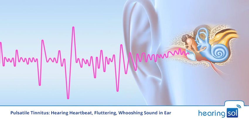 Pulsatile Tinnitus: Hearing Heartbeat, Fluttering, Whooshing Sound in Ear