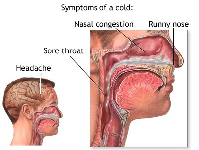 Common Cold Symptoms